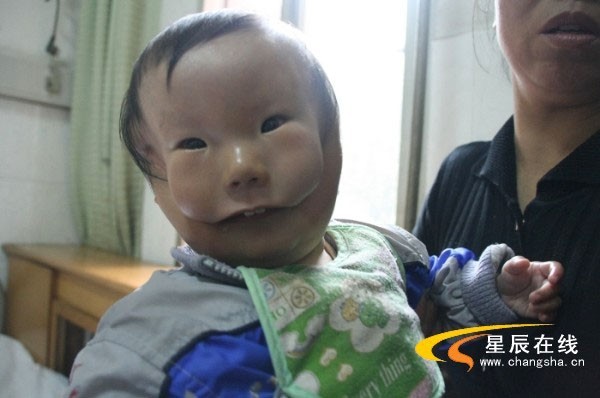 Çin, çift suratlı bebeğin şokunda - Resim: 1