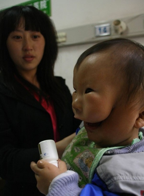 Çin, çift suratlı bebeğin şokunda - Resim: 2