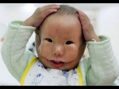 Çin, çift suratlı bebeğin şokunda - Resim: 3