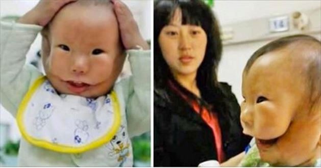 Çin, çift suratlı bebeğin şokunda - Resim: 4