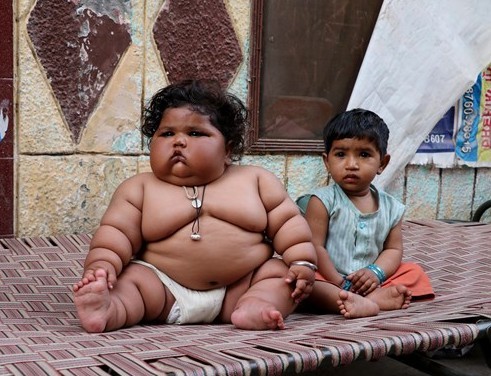8 aylık bebeğin kilolarıyla başı dertte - Resim: 2
