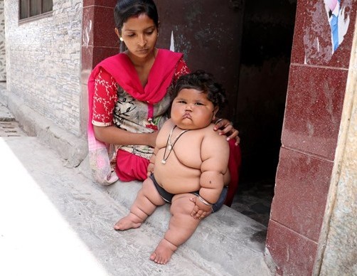8 aylık bebeğin kilolarıyla başı dertte - Resim: 3
