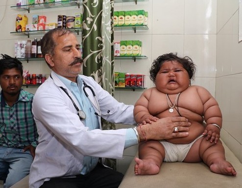 8 aylık bebeğin kilolarıyla başı dertte - Resim: 4