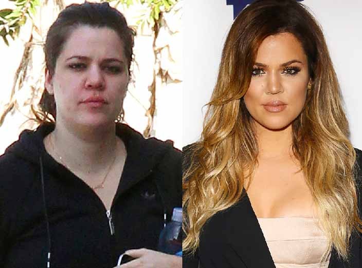 Kardashian ve Jenner ailesinin estetik sonrası değişimleri.. - Resim: 3