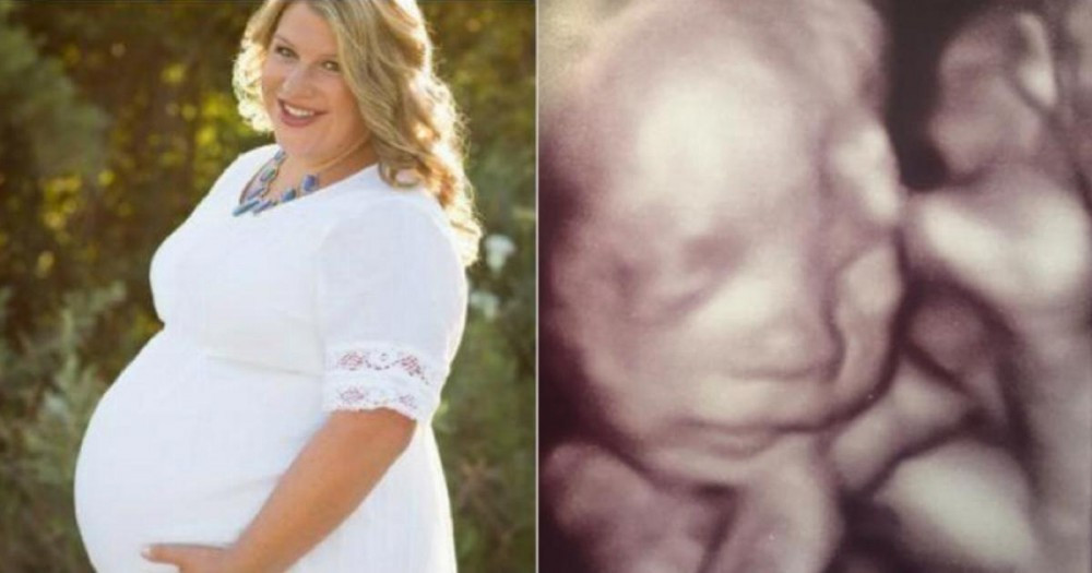 Eşi vefat ettikten sonra hamile olduğunu öğrendi ultrasonda müjdeyi aldı - Resim: 1