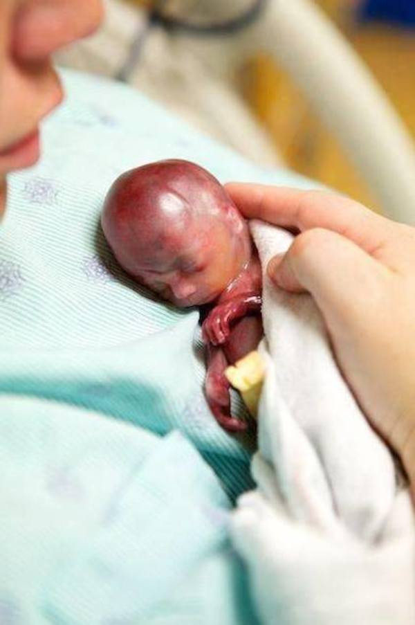 19 haftalıkken bebeği dünyaya geldi, kucağına aldığında... - Resim: 4