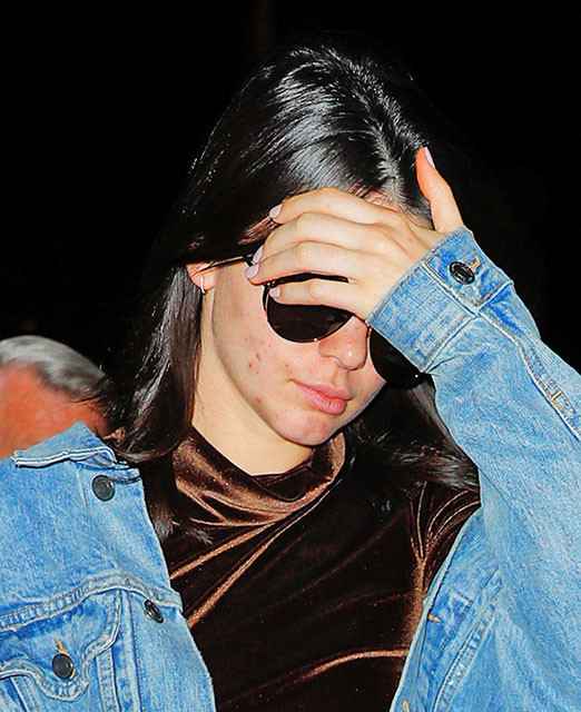 Kendall Jenner'ın sivilceleri alay konusu oldu - Resim: 3