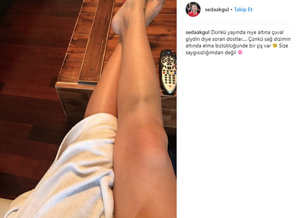 Seda Akgül'den bacak fotoğrafıyla yanıt - Resim: 4