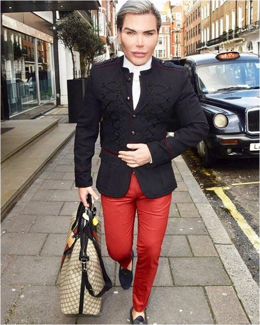 Rodrigo Alves dört kaburgasını aldıran ilk erkek oldu - Resim: 4