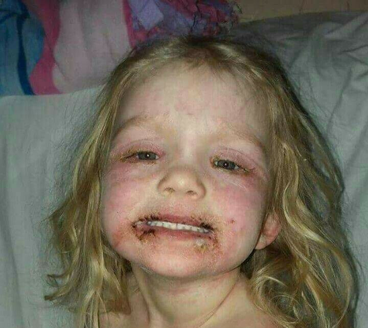 Oyuncak makyaj seti küçük kızı hastanelik etti - Resim: 1