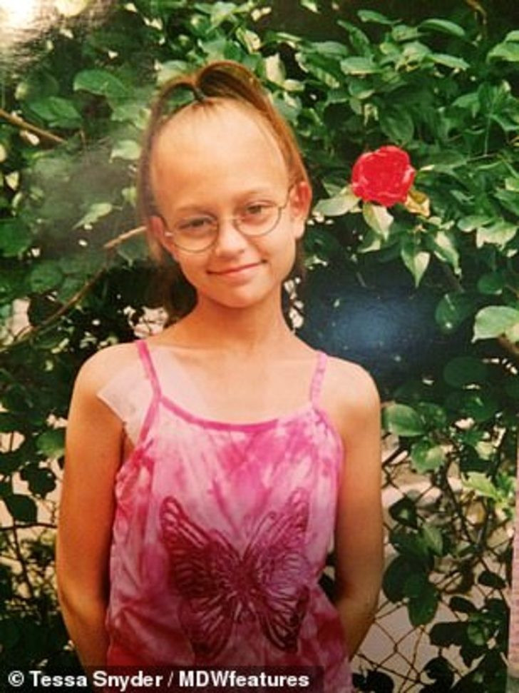 Tessa Snyder'ın 11 yaşında kanser yüzünden bacağı kesildi! Şimdi markalar peşinde koşuyor - Resim: 3