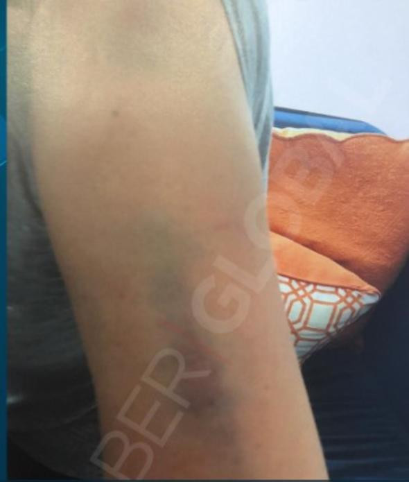 Ahmet Kural Sıla kavgasında şok iddia: Sırtında vazo kırdı, omzunu ısırdı - Resim: 3