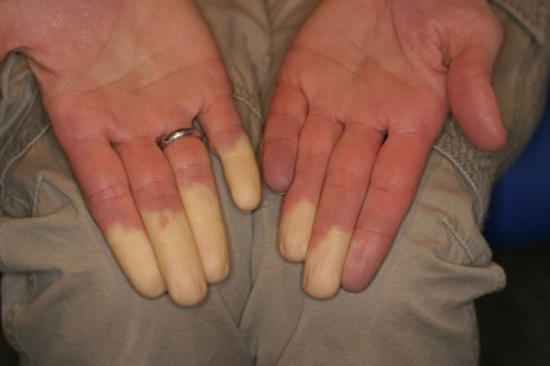 Ünlü sunucunun farklı renkteki parmakları - Resim: 4