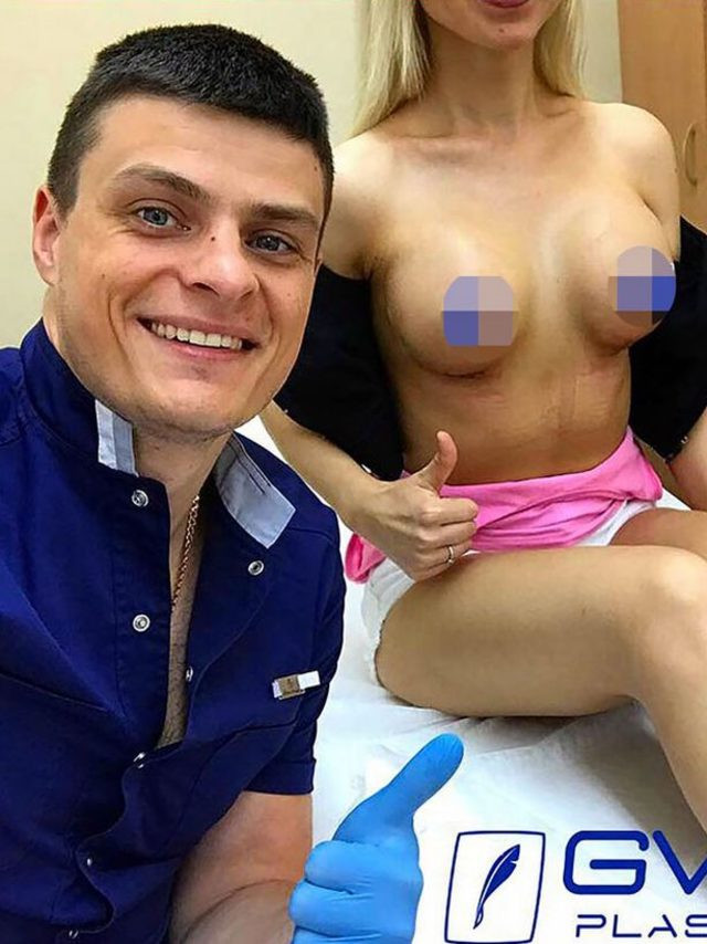 Göğüs dikleştirme ameliyatından sonra acı son! - Resim: 3