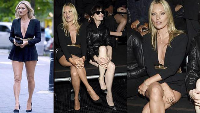 Kate Moss'un bacakları olay oldu - Resim: 1