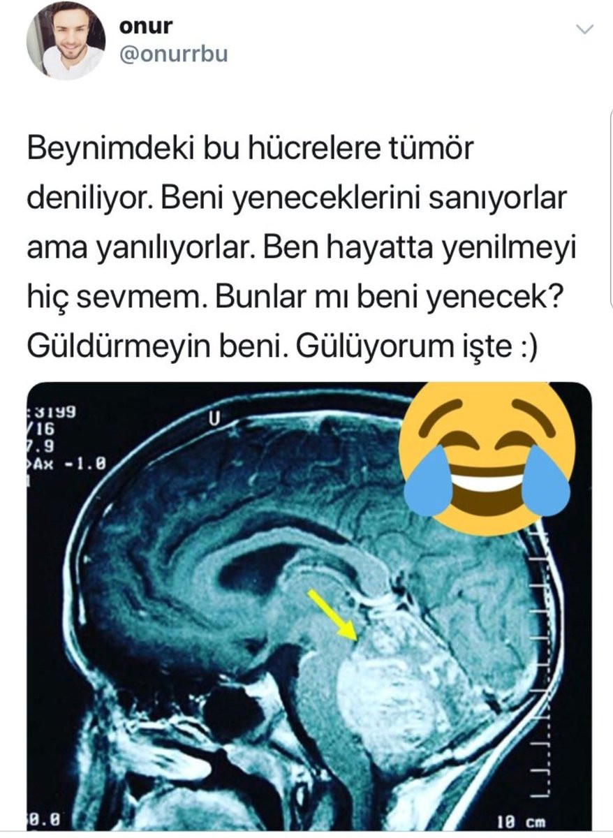 Sosyal medyada dikkat çekmek için kanser olduğunu iddia etti! - Resim: 3