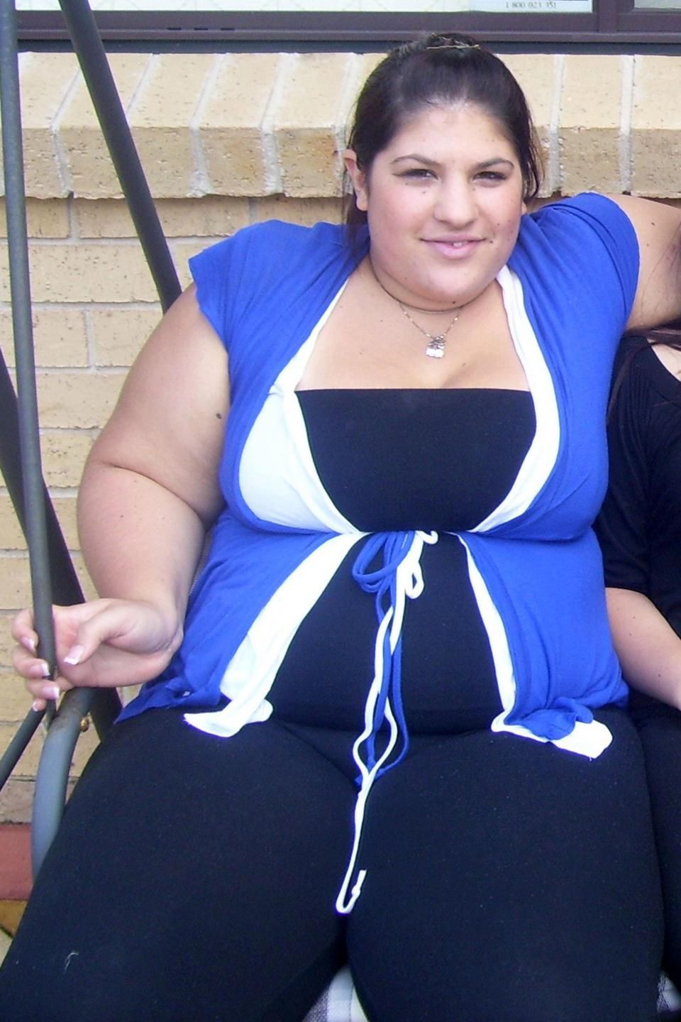 Obez kadın yeni kilosuyla şoke etti! İşte diyet listesi - Resim: 1
