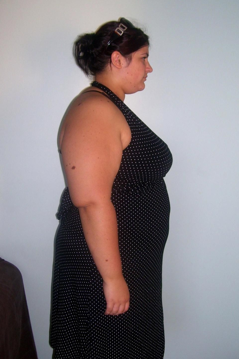 Obez kadın yeni kilosuyla şoke etti! İşte diyet listesi - Resim: 2