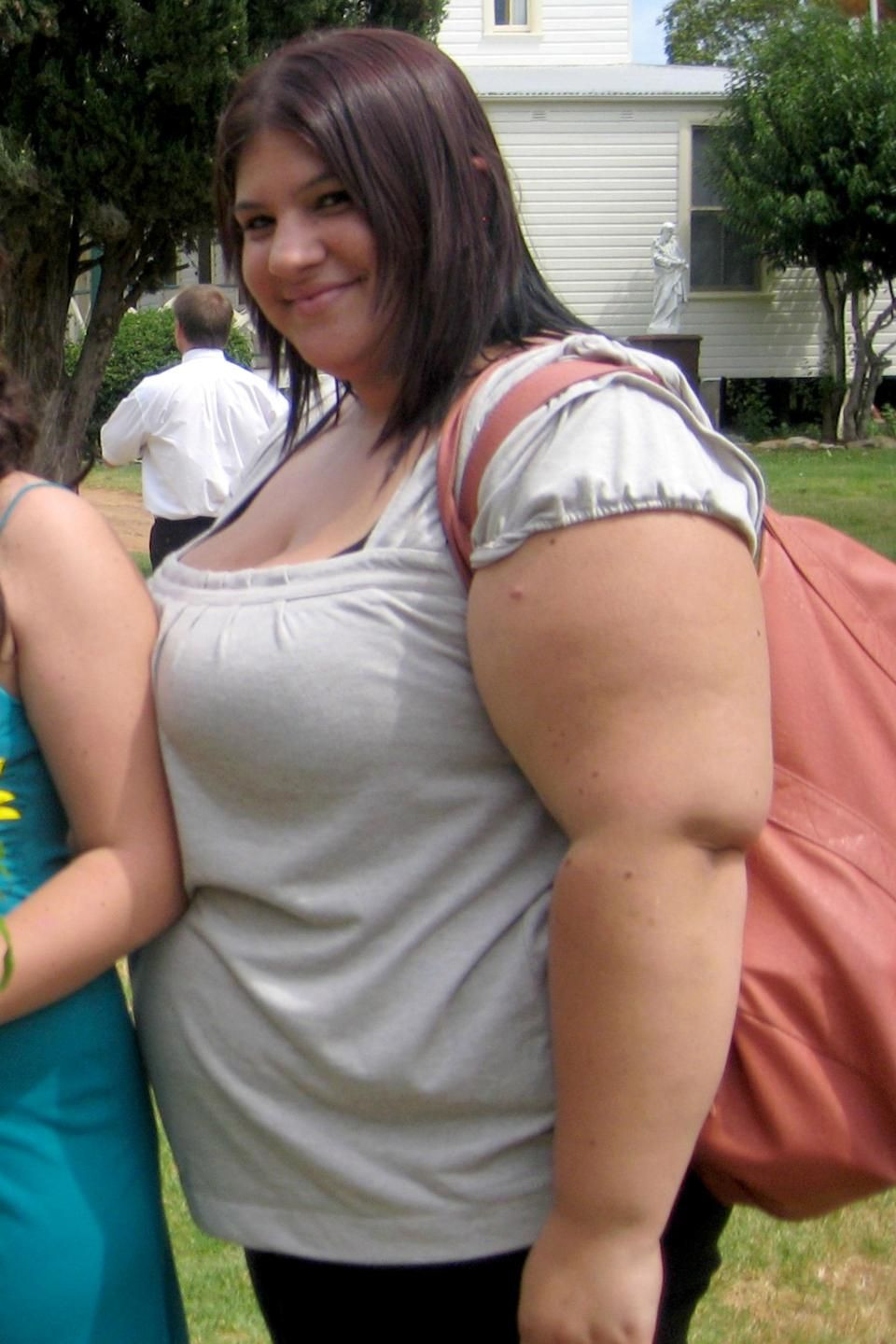 Obez kadın yeni kilosuyla şoke etti! İşte diyet listesi - Resim: 3