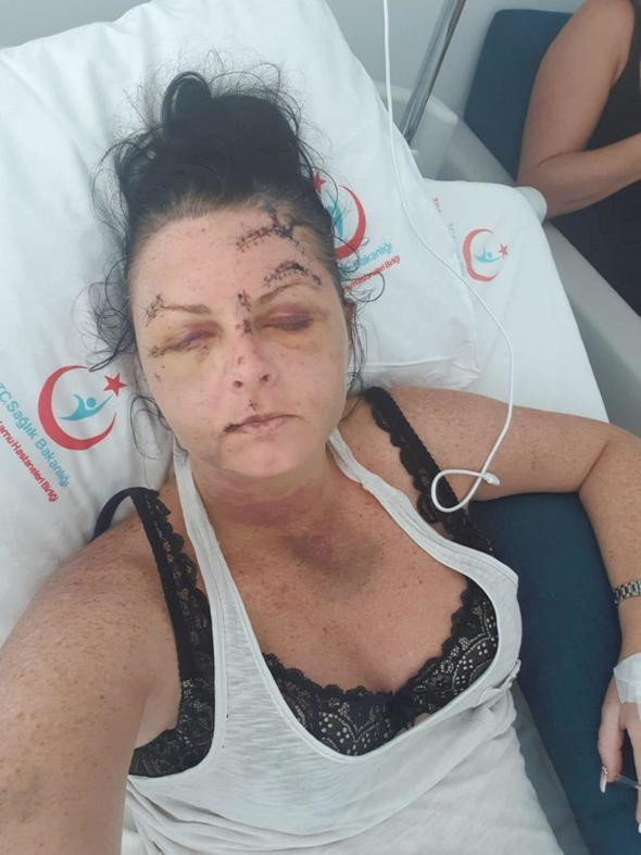 Marmaris'te saldırıya uğrayan turist kadın konuştu - Resim: 2