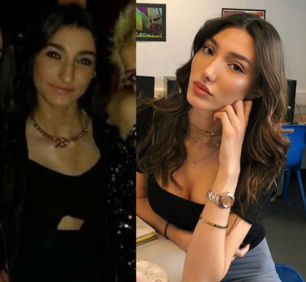 Miss Turkey 2018 birincisi Şevval Şahin'in estetiksiz hali ortaya çıktı - Resim: 3