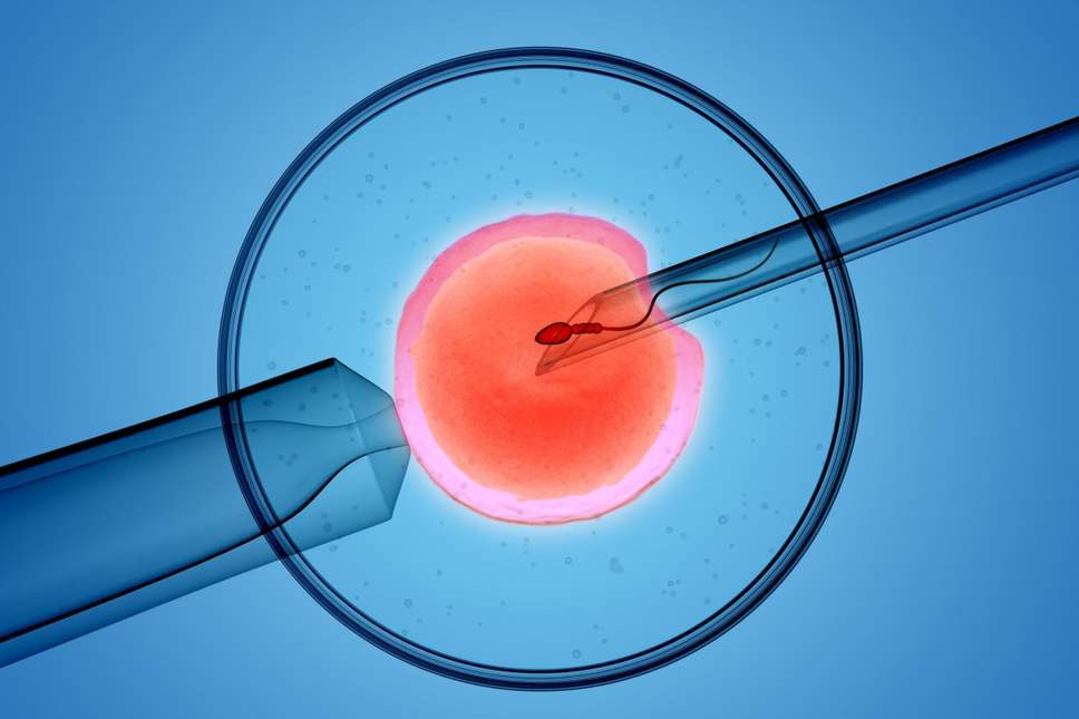 Tüp bebek tedavisi gören kadın kocasının spermlerini sevgilisinin spermleriyle değiştirdi - Resim: 1