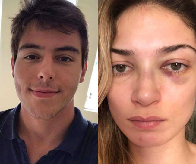 Cani erkek arkadaş kız arkadaşını kamera önünde dövdü - Resim: 1
