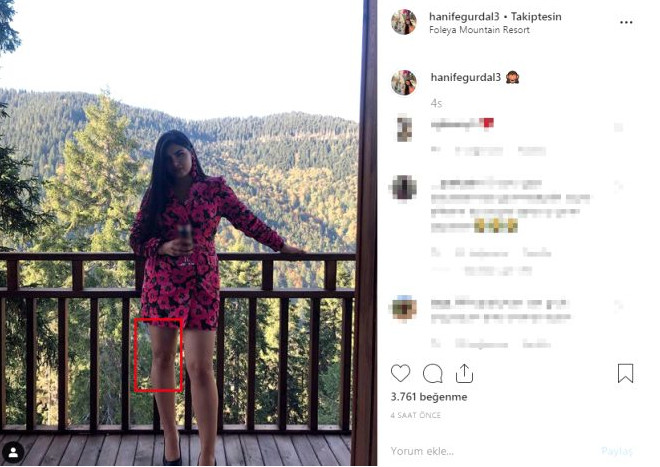 Mini elbiseli pozunu paylaşan Hanife Gürdal photoshopla bacağını inceltti - Resim: 2