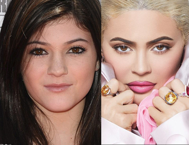 Kylie Jenner estetik iddialarına yanıt verdi - Resim: 4