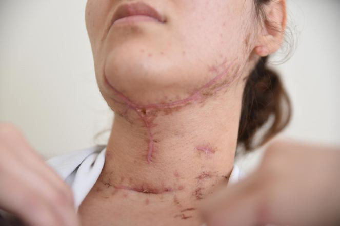 Genç kadının falçatayla boğazını kesti tecavüz etmeye çalıştı - Resim: 1