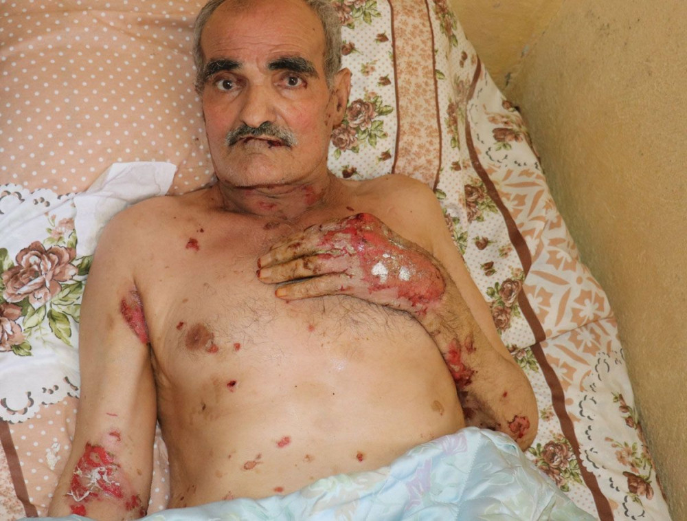 Vücudunu ve ağzının içini saran yaralar kabusu oldu! Suriyeli adamın yürek yakan feryadı - Resim: 4