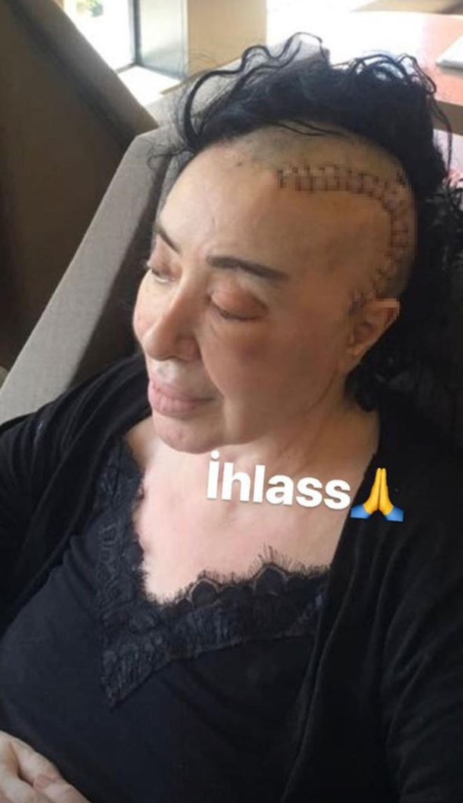 Nur Yerlitaş sağlık durumunu canlı yayında anlattı - Resim: 1