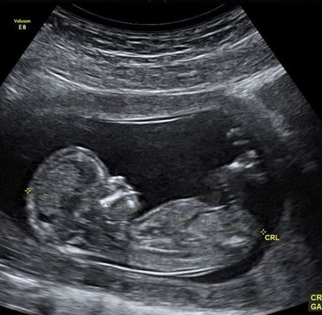 Justin Bieber eşi Hailey Baldwin'in hamile olduğunu açıklamıştı, özür diledi - Resim: 4