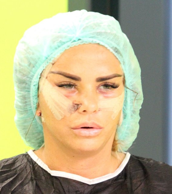 Katie Price İstanbul'da estetik ameliyat oldu - Resim: 2