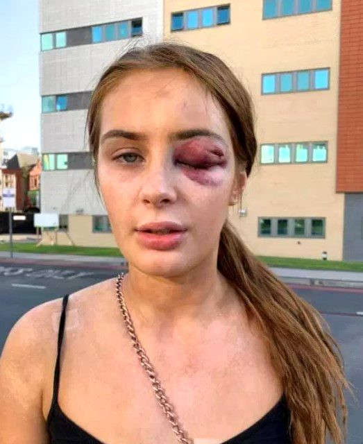 Eğlenelim teklifini kabul etmeyen genç kadın tekme tokat dövüldü - Resim: 1