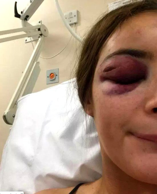 Eğlenelim teklifini kabul etmeyen genç kadın tekme tokat dövüldü - Resim: 2