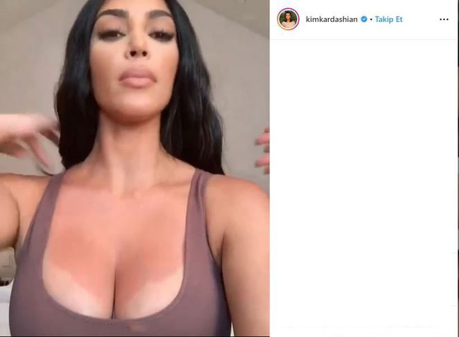 Kim Kardashian güneş yanığı oldu, kendi reklamını yaptı - Resim: 1