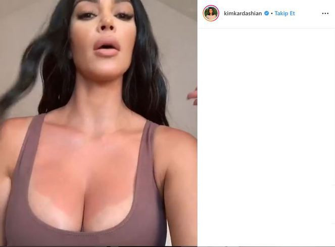 Kim Kardashian güneş yanığı oldu, kendi reklamını yaptı - Resim: 2