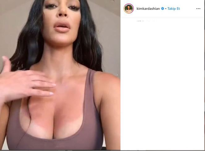 Kim Kardashian güneş yanığı oldu, kendi reklamını yaptı - Resim: 4