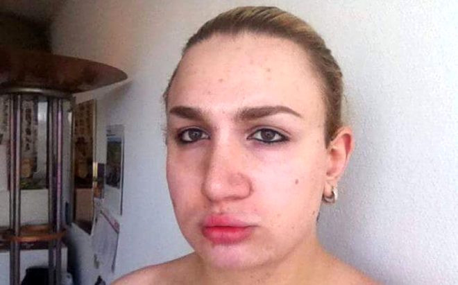 Trans kadın Ivana müşterilerin cinsel organlarına tuz enjekte ediyor! - Resim: 1