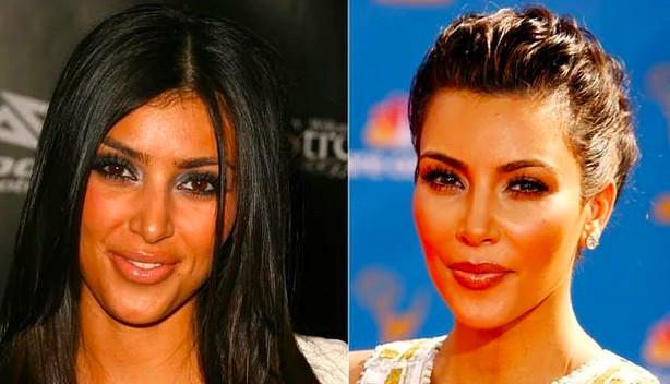 Kim Kardashian estetik mi yaptırdı? - Resim: 2