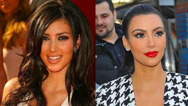 Kim Kardashian estetik mi yaptırdı? - Resim: 3