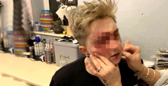20 yaşındaki eşcinsel kıza sokak ortasında saldırı - Resim: 1
