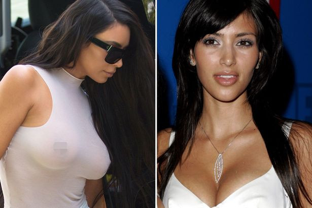 Kim Kardashian'ın estetiksiz hali şaşırttı! - Resim: 2