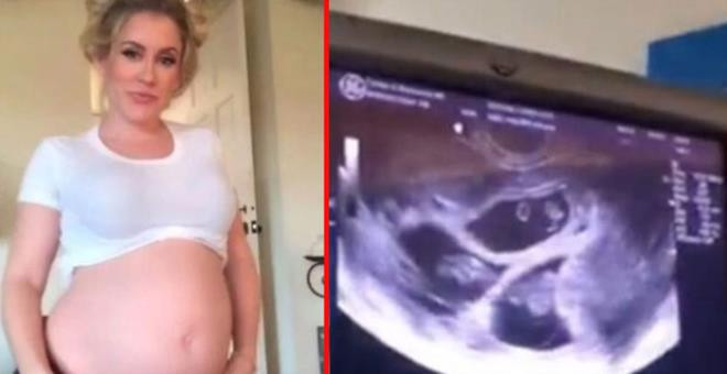 İkizlere hamile olan fenomen, 10 gün sonra tekrar hamile kaldı - Resim: 3
