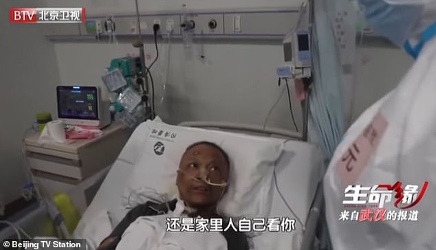 Koronaya yakalanan Çinli doktorların cilt rengi değişti - Resim: 3