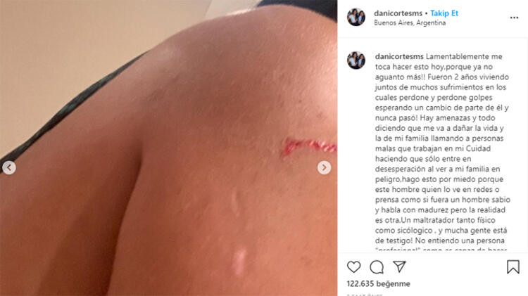 Boca'lı yıldız futbolcu Villa'nın kız arkadaşı darp görüntülerini paylaştı - Resim: 4