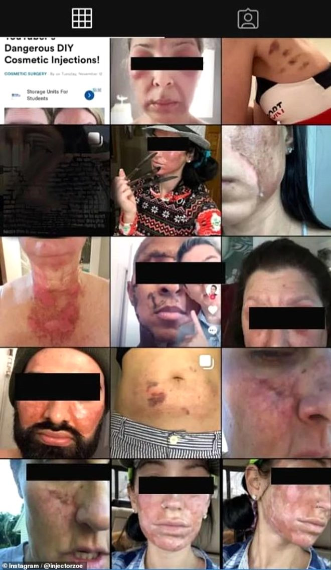 Cilt temizleme losyonu kullanan kadınların yüzleri yandı - Resim: 4