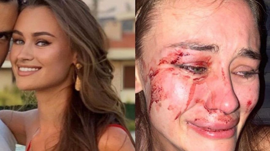 Momo Beach’te özel güvenlikçilerin saldırdığı model Daria Kyryliuk kimdir? - Resim: 1