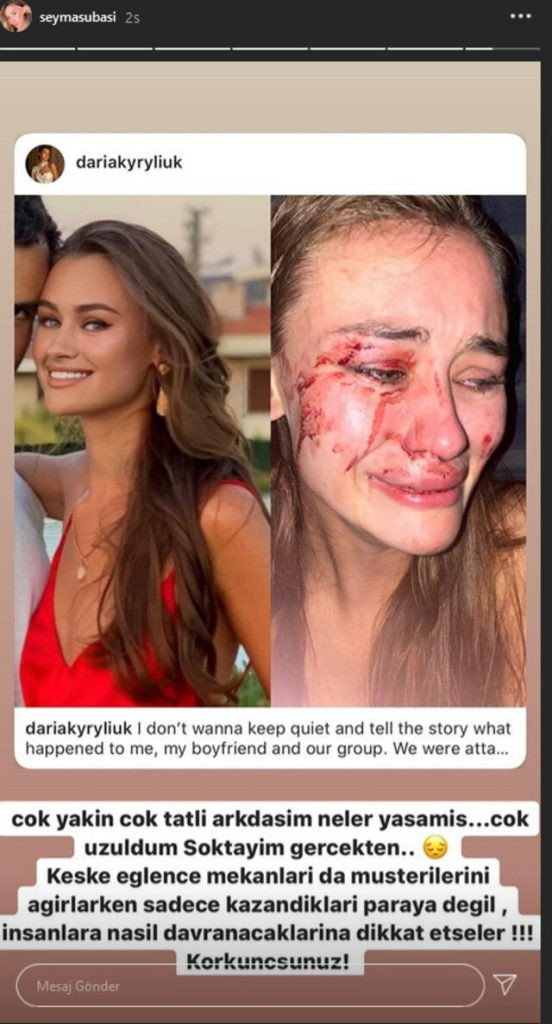 Momo Beach’te özel güvenlikçilerin saldırdığı model Daria Kyryliuk kimdir? - Resim: 3